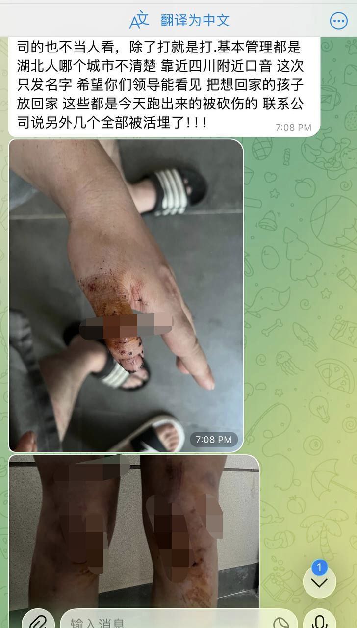 爆料：波贝黑园区，冲园区，冲出来十几个中国人，后面门口本地保安拿刀砍人，砍伤了几个